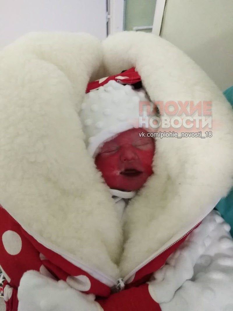 Соцсети шокировали фотографии мертвого ребенка, одетого в костюм Деда Мороза (5 фото)