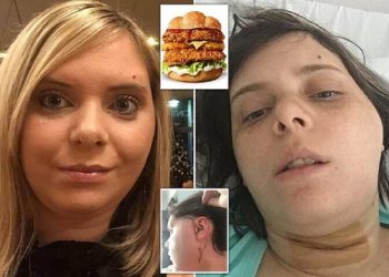 Женщина сломала челюсть бургером (8 фото)