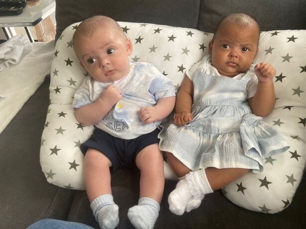 Британка родила близнецов с разным цветом кожи (3 фото)