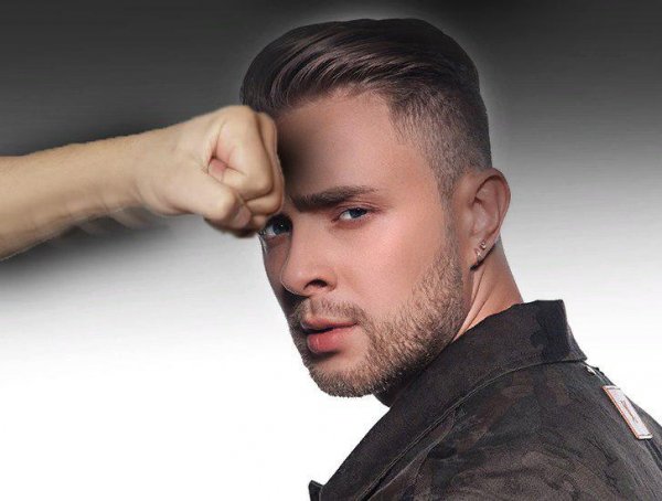 Кто побил Крида? Егор Крид показался с шишкой на лбу
