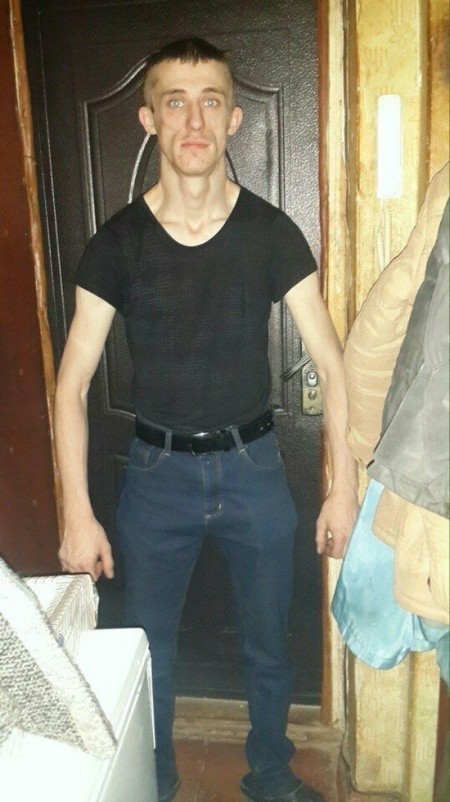 Синдром очень широкой спины или “жертвы качалки” (19 фото)