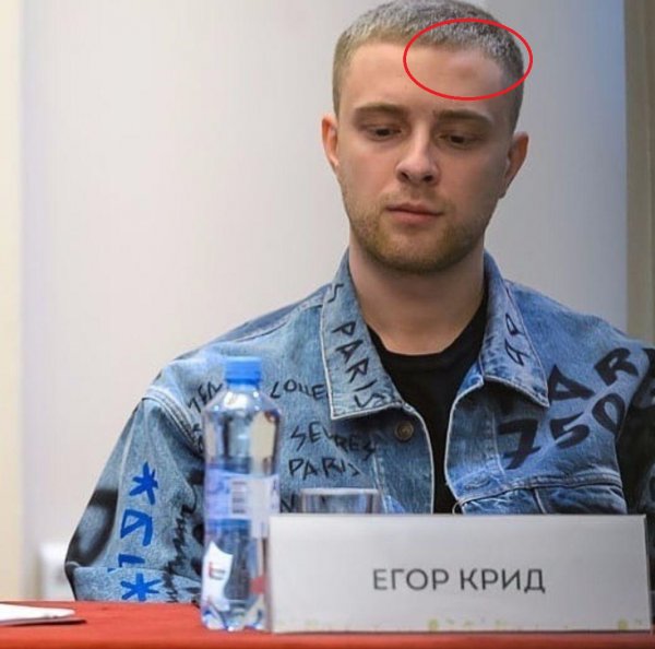 Кто побил Крида? Егор Крид показался с шишкой на лбу
