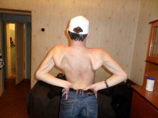 Синдром очень широкой спины или “жертвы качалки” (19 фото)