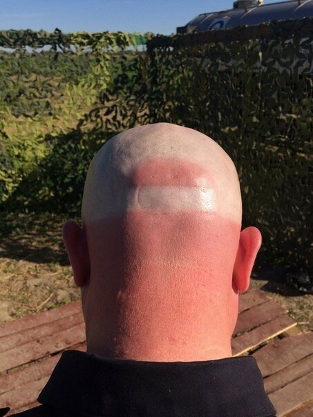 Сезон загара открыт! (19 фото)