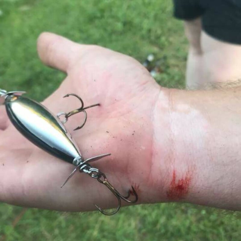 20 худших фото из отпусков, в которых что-то пошло не так (22 фото)