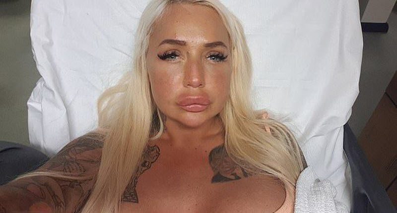 Порнозвезда хотела избавиться от "старых" губ, а получила другой результат (7 фото)