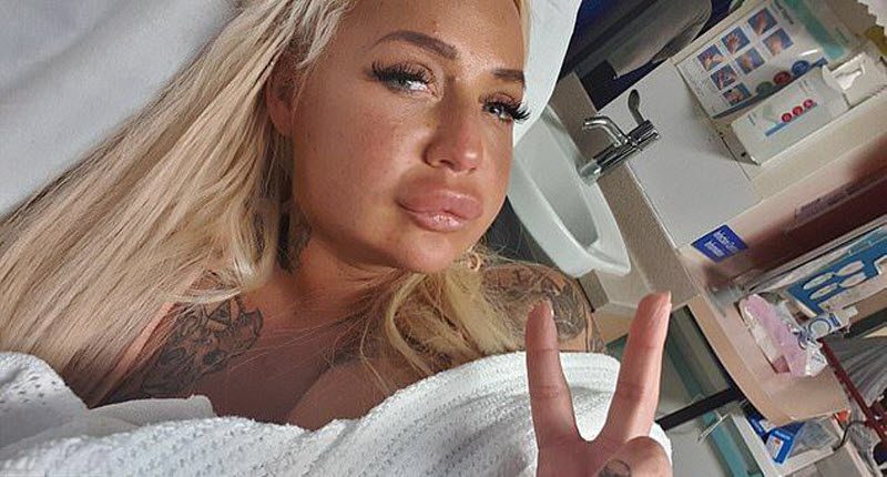 Порнозвезда хотела избавиться от "старых" губ, а получила другой результат (7 фото)