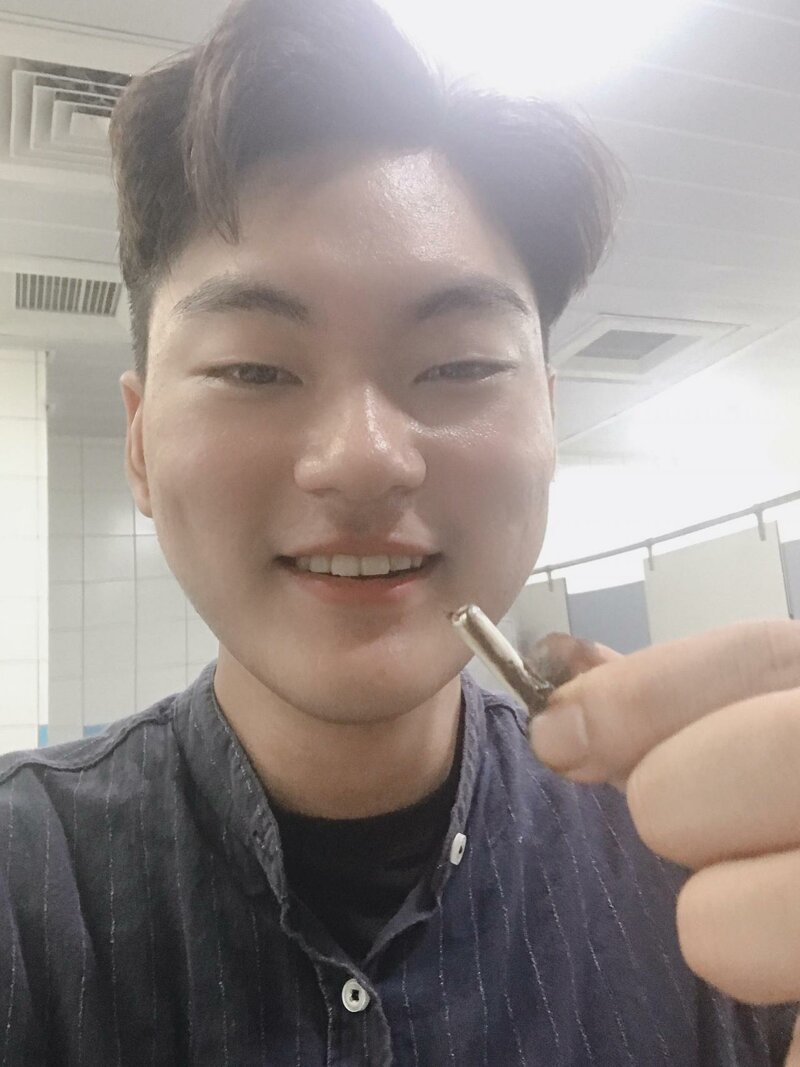 Китаец проглотил наушник AirPod: удивительные приключения гаджета в пищеварительной системе (4 фото)