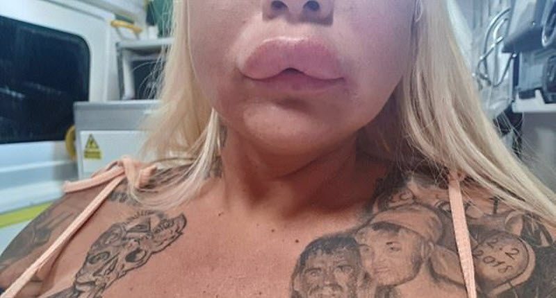 Порнозвезда хотела избавиться от "старых" губ, а получила другой результат (7 фото)