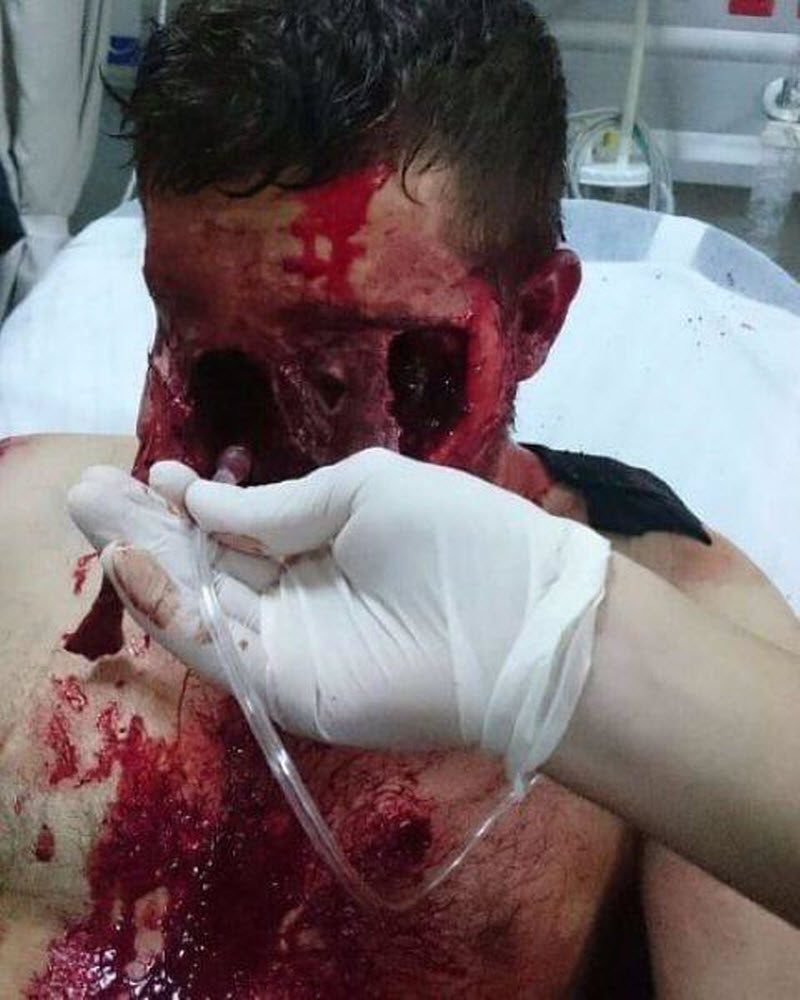 Не был пристегнут в ДТП и что из этого вышло (4 фото) (жесть)