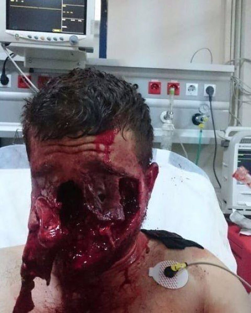 Не был пристегнут в ДТП и что из этого вышло (4 фото) (жесть)