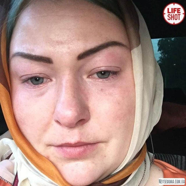 Жительница Москвы решила осветлить волосы (7 фото)