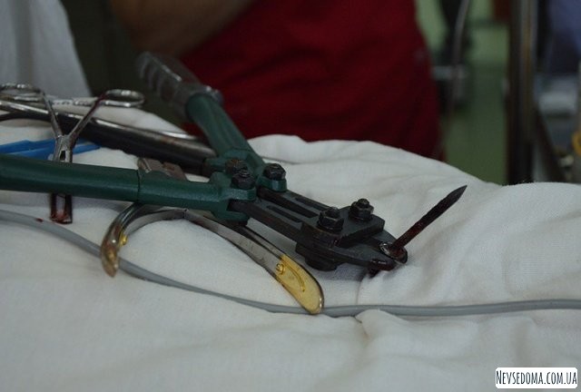 Доктор, у меня голова болит. Житель Хабаровского края два года прожил гвоздем в носоглотке