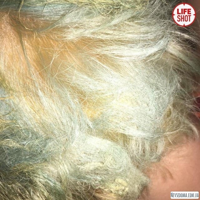 Жительница Москвы решила осветлить волосы (7 фото)