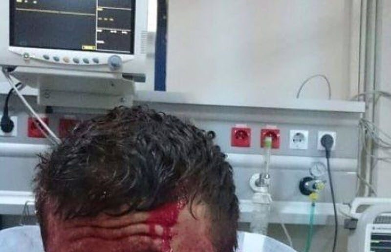 Не был пристегнут в ДТП и что из этого вышло (4 фото) (жесть)