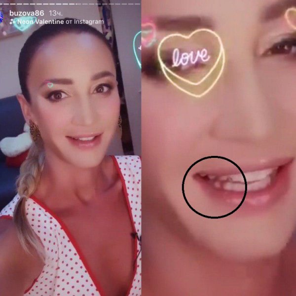 Бузова «спалила» беззубый рот. Батруха «постарался»?
