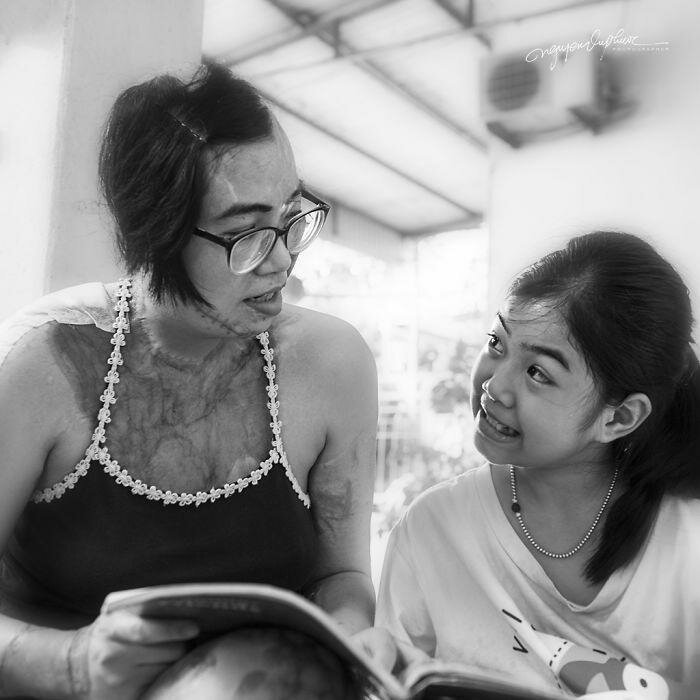 На женщину напал бывший муж и облил кислотой, она могла умереть, но выжила (14 фото) На женщину напал бывший муж и облил кислотой, она могла умереть, но выжила (14 фото)