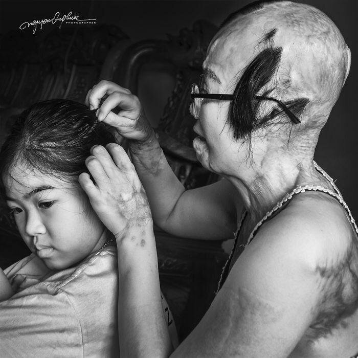 На женщину напал бывший муж и облил кислотой, она могла умереть, но выжила (14 фото) На женщину напал бывший муж и облил кислотой, она могла умереть, но выжила (14 фото)