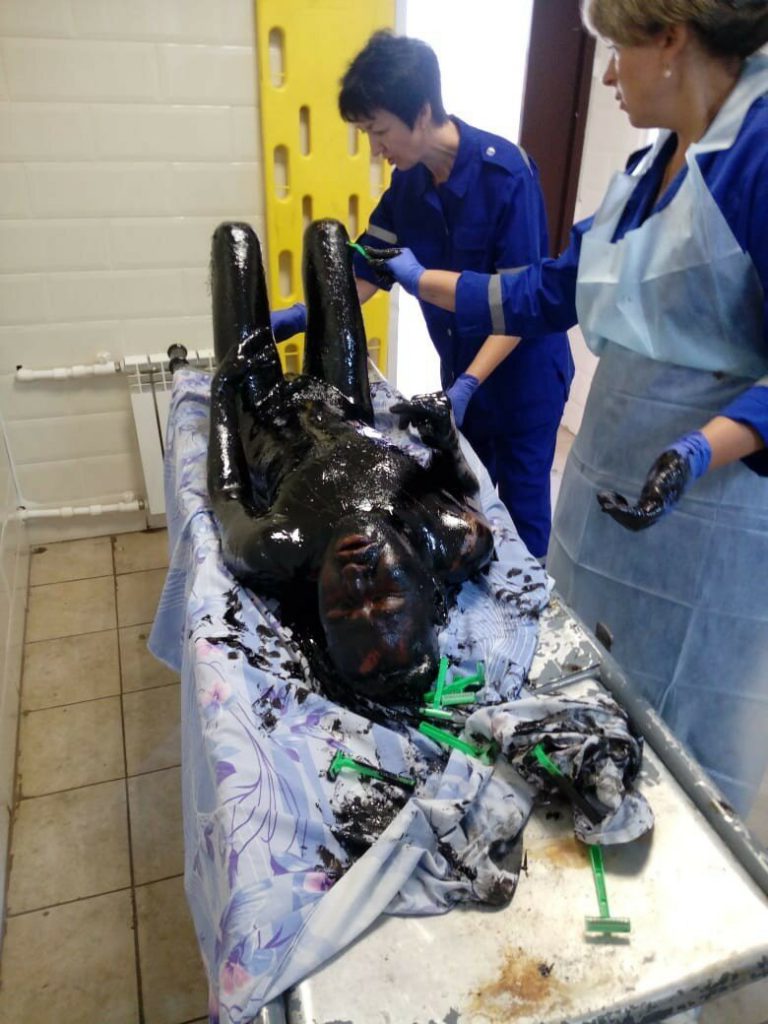 Врачи отчистили и спасли провалившегося в битум жителя Павловска (8 фото) Врачи отчистили и спасли провалившегося в битум жителя Павловска (8 фото)