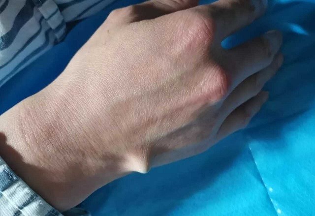 Как не надо открывать пиво, когда нет открывалки (2 фото + 2 видео)