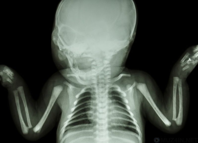 Удивительные научные факты о новорожденных (9 фото) Удивительные научные факты о новорожденных (9 фото)