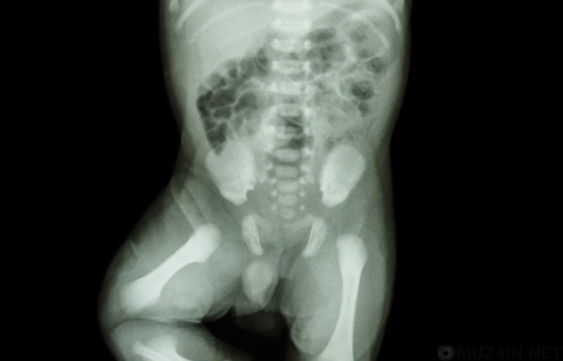 Удивительные научные факты о новорожденных (9 фото) Удивительные научные факты о новорожденных (9 фото)