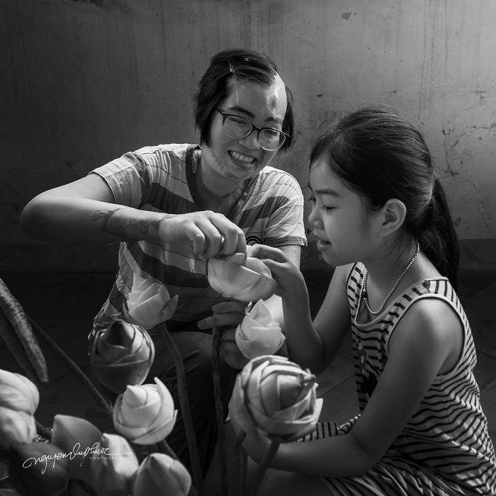 На женщину напал бывший муж и облил кислотой, она могла умереть, но выжила (14 фото) На женщину напал бывший муж и облил кислотой, она могла умереть, но выжила (14 фото)