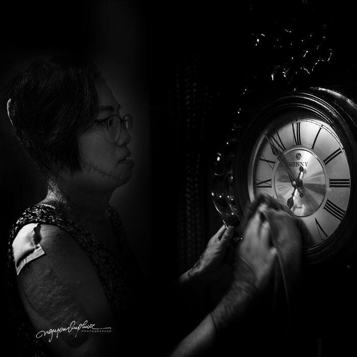 На женщину напал бывший муж и облил кислотой, она могла умереть, но выжила (14 фото) На женщину напал бывший муж и облил кислотой, она могла умереть, но выжила (14 фото)