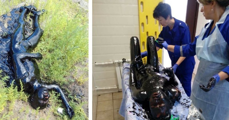 Врачи отчистили и спасли провалившегося в битум жителя Павловска (8 фото) Врачи отчистили и спасли провалившегося в битум жителя Павловска (8 фото)