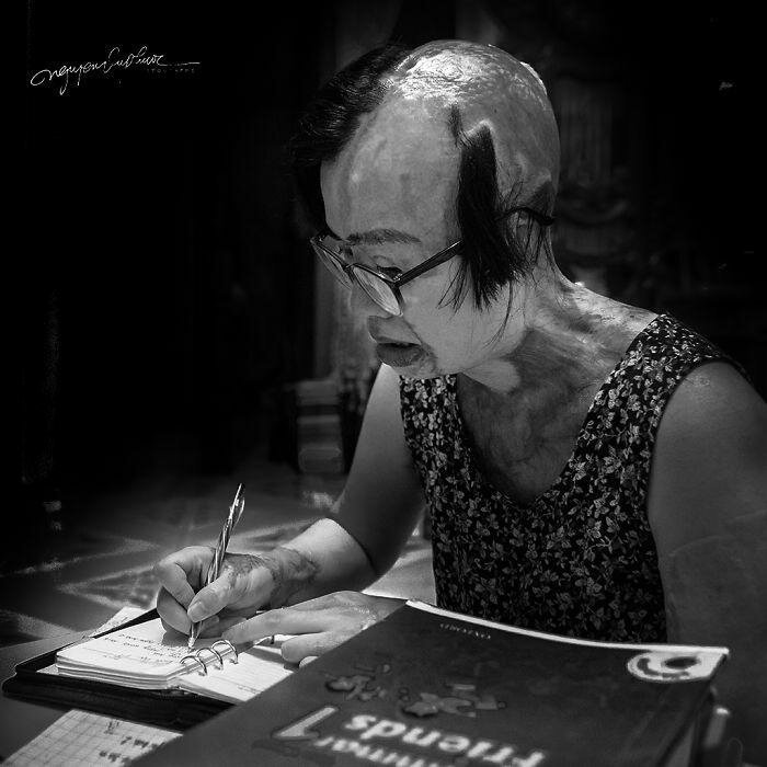 На женщину напал бывший муж и облил кислотой, она могла умереть, но выжила (14 фото) На женщину напал бывший муж и облил кислотой, она могла умереть, но выжила (14 фото)