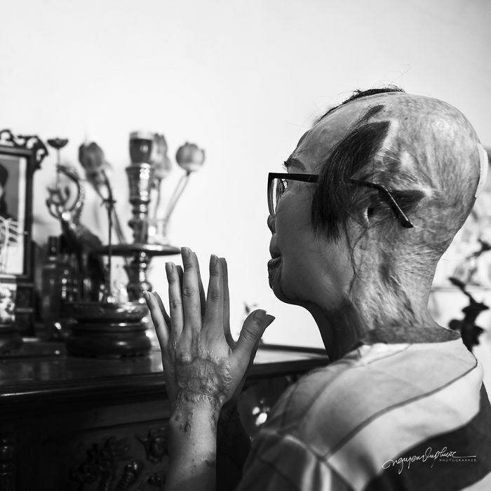 На женщину напал бывший муж и облил кислотой, она могла умереть, но выжила (14 фото) На женщину напал бывший муж и облил кислотой, она могла умереть, но выжила (14 фото)