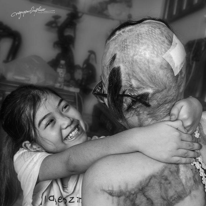 На женщину напал бывший муж и облил кислотой, она могла умереть, но выжила (14 фото) На женщину напал бывший муж и облил кислотой, она могла умереть, но выжила (14 фото)