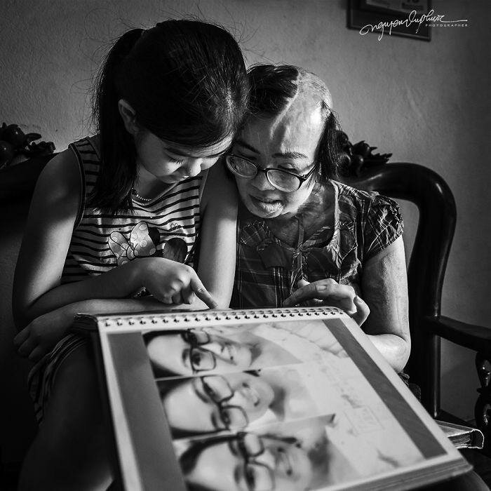 На женщину напал бывший муж и облил кислотой, она могла умереть, но выжила (14 фото) На женщину напал бывший муж и облил кислотой, она могла умереть, но выжила (14 фото)