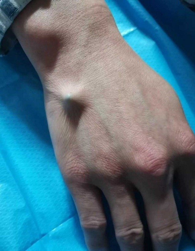 Как не надо открывать пиво, когда нет открывалки (2 фото + 2 видео)