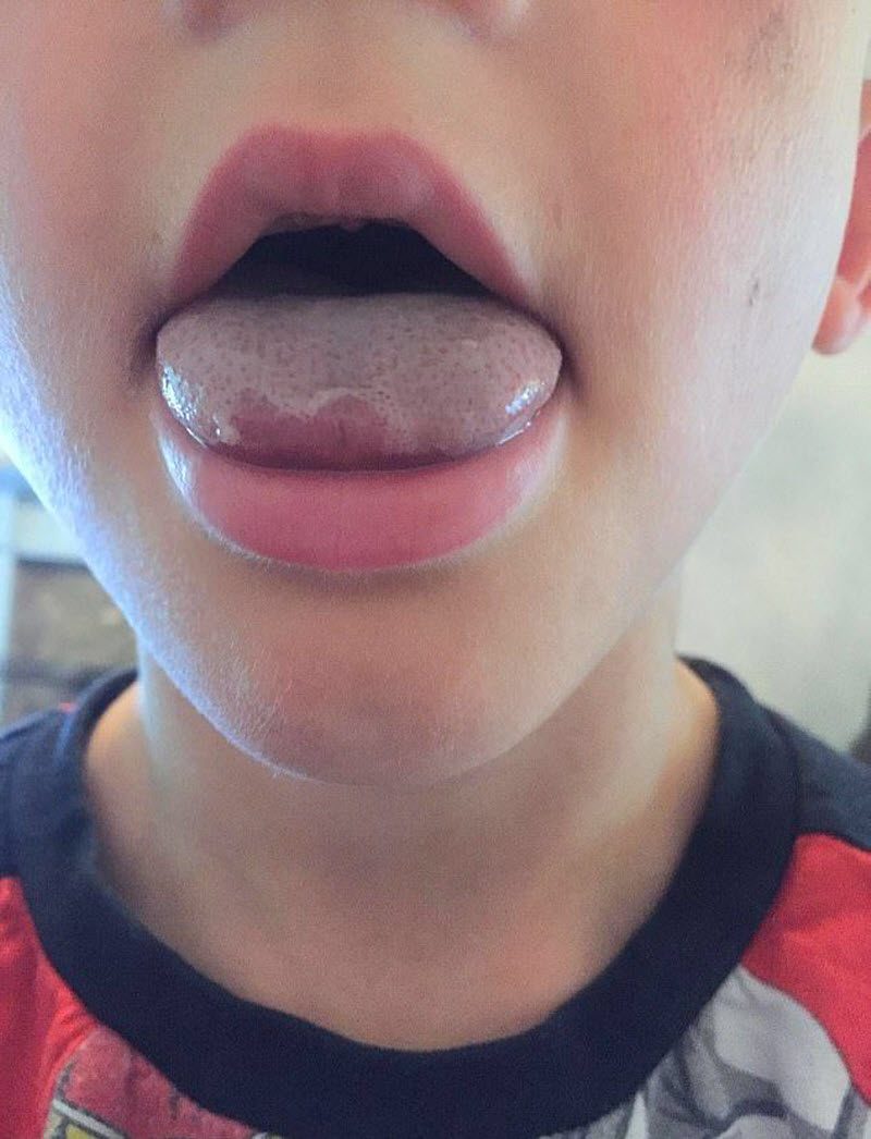 Пацан засунул язык в бутылку для воды (4 фото)