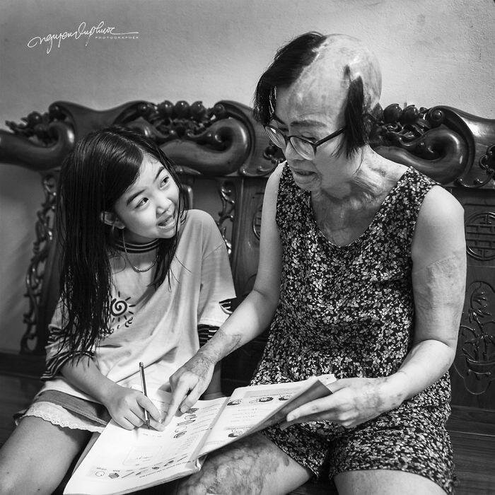 На женщину напал бывший муж и облил кислотой, она могла умереть, но выжила (14 фото) На женщину напал бывший муж и облил кислотой, она могла умереть, но выжила (14 фото)