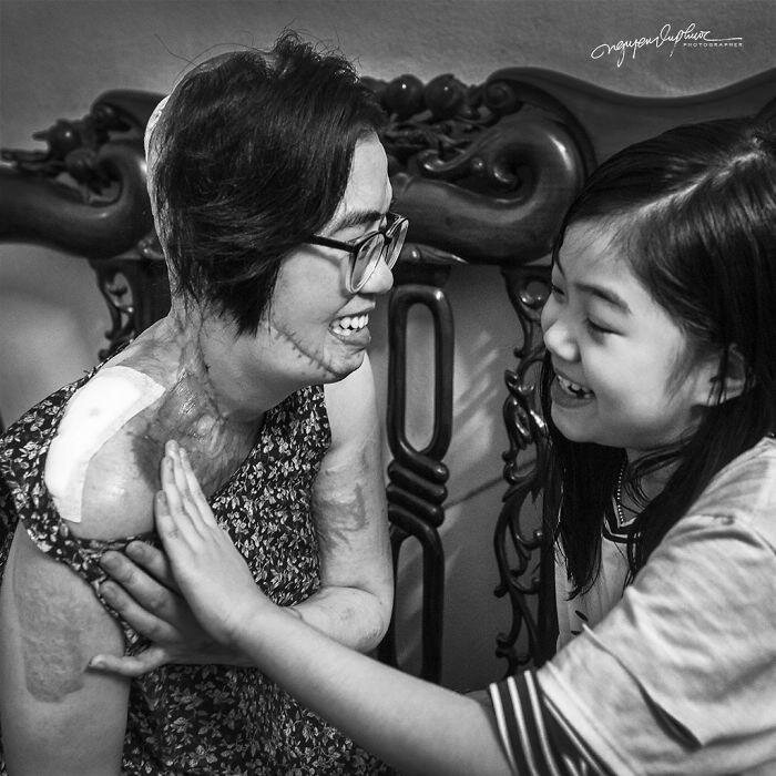 На женщину напал бывший муж и облил кислотой, она могла умереть, но выжила (14 фото) На женщину напал бывший муж и облил кислотой, она могла умереть, но выжила (14 фото)