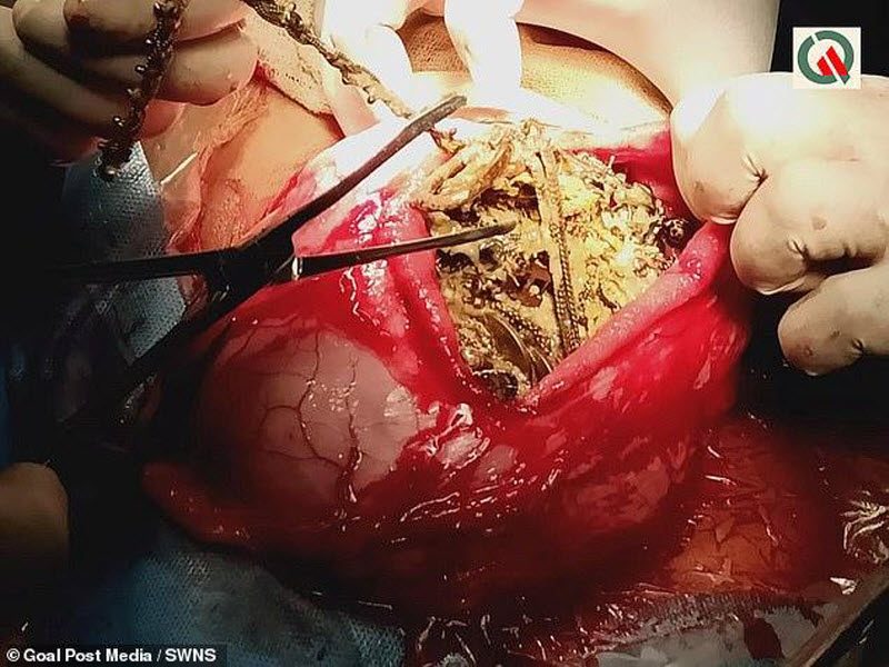 Девушка почувствовала себя плохо и обратилась в больницу (3 фото)