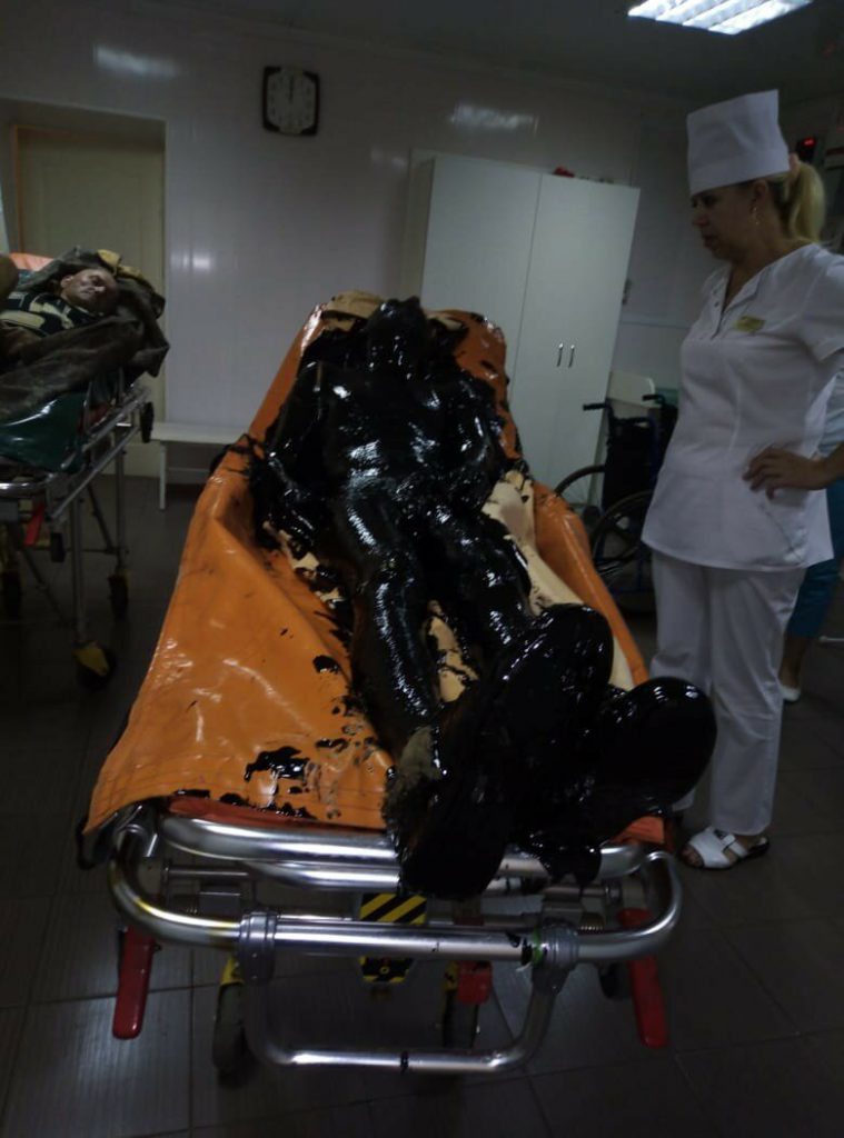 Врачи отчистили и спасли провалившегося в битум жителя Павловска (8 фото) Врачи отчистили и спасли провалившегося в битум жителя Павловска (8 фото)