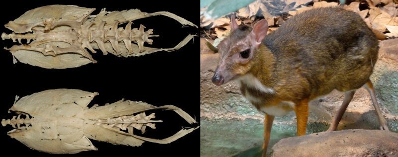 Каменные люди: фибродисплазия - история болезни (12 фото)