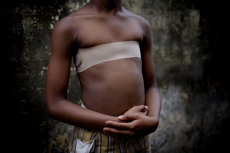 Покалечить ради красоты: ужасающие традиции племен и народов (23 фото)