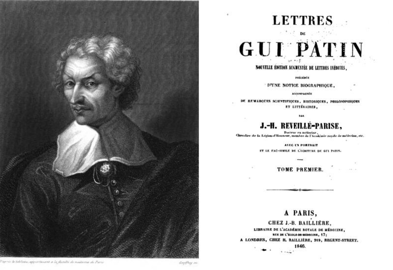 Каменные люди: фибродисплазия - история болезни (12 фото)