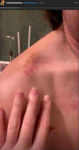 #Наташапрости. Малахов извинился перед женой за фото с любовницей
