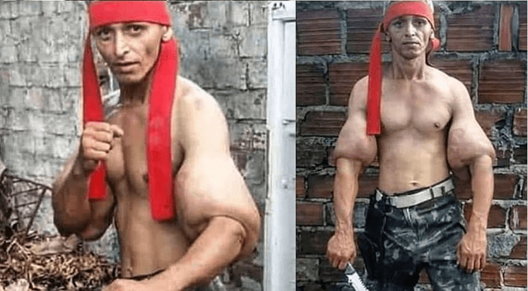 Фанат Сталлоне закачал в руки синтол, чтобы быть как Рэмбо (3 фото)