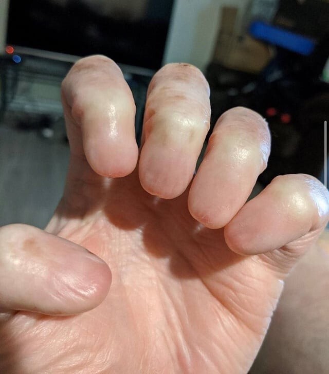 Странности и аномалии человеческого тела, от которых просто глаза лезут на лоб (24 фото) Странности и аномалии человеческого тела, от которых просто глаза лезут на лоб (24 фото)