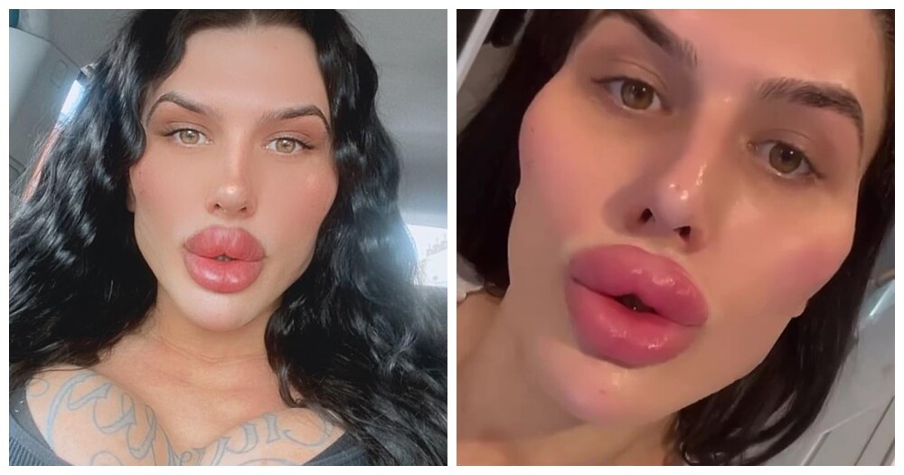 Британка хочет накачать губы так, чтобы обойти нынешнюю рекордсменку мира (10 фото + 1 видео)