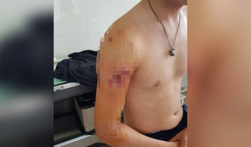 Под Магаданом медведь пришёл в палаточный лагерь и набросился на молодого исследователя (4 фото) Под Магаданом медведь пришёл в палаточный лагерь и набросился на молодого исследователя (4 фото)