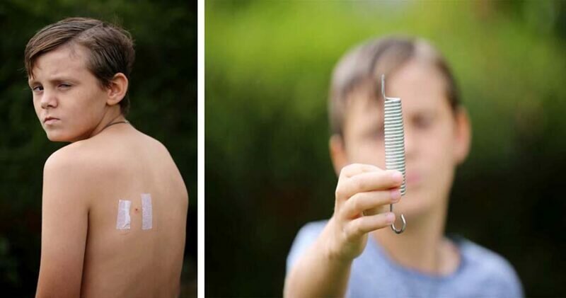 В Британии 12-летний мальчик получил весьма необычную травму, прыгая на батуте (4 фото)