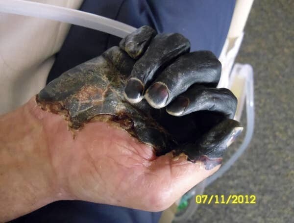 Странности и аномалии человеческого тела, от которых просто глаза лезут на лоб (24 фото)