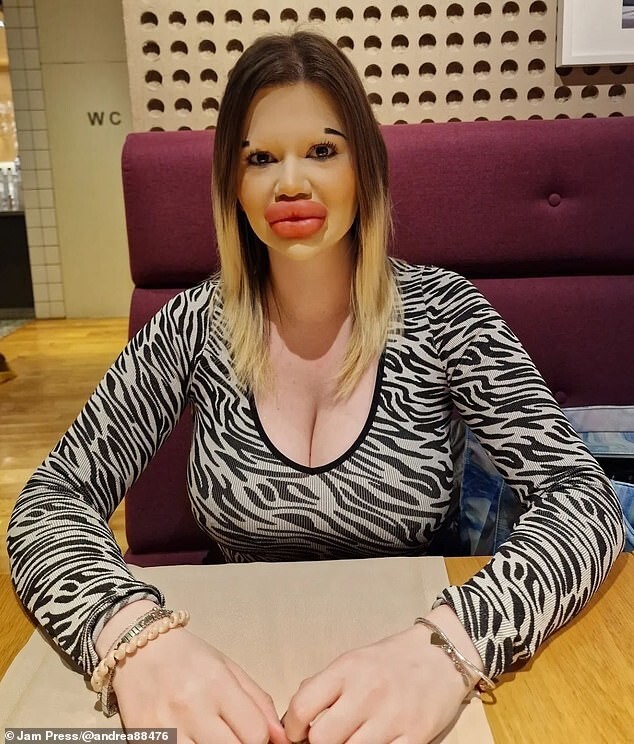 Британка хочет накачать губы так, чтобы обойти нынешнюю рекордсменку мира (10 фото + 1 видео) Британка хочет накачать губы так, чтобы обойти нынешнюю рекордсменку мира (10 фото + 1 видео)